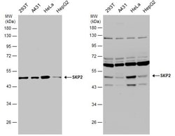 Invitrogen SKP2 Polyclonal Antibody 100 &mu;L; Unconjugated:Antibodies,
