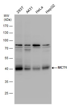 MCT1 Polyclonal Antibody:Antibodies, Polyclonal