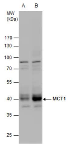 MCT1 Polyclonal Antibody:Antibodies, Polyclonal