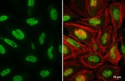 Invitrogen SMARCA2 Polyclonal Antibody 100 &mu;L | Buy Online | Invitrogen&trade; | Fisher Scientific