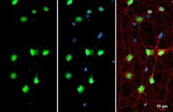 Invitrogen&trade;&nbsp;SMARCA2 Polyclonal Antibody