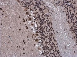 Invitrogen SMARCA2 Polyclonal Antibody 100 &mu;L | Buy Online | Invitrogen&trade; | Fisher Scientific