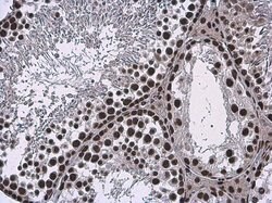Invitrogen SMARCA2 Polyclonal Antibody 100 &mu;L | Buy Online | Invitrogen&trade; | Fisher Scientific