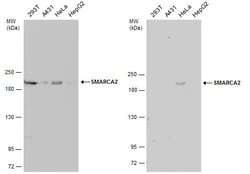 Invitrogen SMARCA2 Polyclonal Antibody 100 &mu;L | Buy Online | Invitrogen&trade; | Fisher Scientific