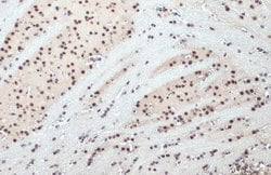 Invitrogen SNRPE Polyclonal Antibody 100 &mu;L; Unconjugated:Antibodies,