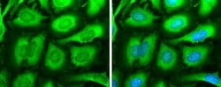 Invitrogen SOS1 Polyclonal Antibody 100 &mu;L; Unconjugated:Antibodies,
