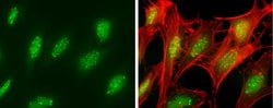 Invitrogen SP100 Polyclonal Antibody 100 &mu;L; Unconjugated:Antibodies,