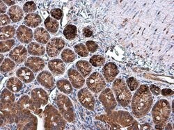 Invitrogen SPARC Polyclonal Antibody 100 &mu;L | Buy Online | Invitrogen&trade; | Fisher Scientific