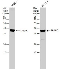 Invitrogen SPARC Polyclonal Antibody 100 &mu;L | Buy Online | Invitrogen&trade; | Fisher Scientific