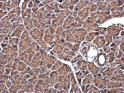 Invitrogen SPTBN1 Polyclonal Antibody 100 &mu;L; Unconjugated:Antibodies,