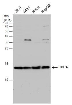 Invitrogen TBCA Polyclonal Antibody 100 &mu;L; Unconjugated:Antibodies,