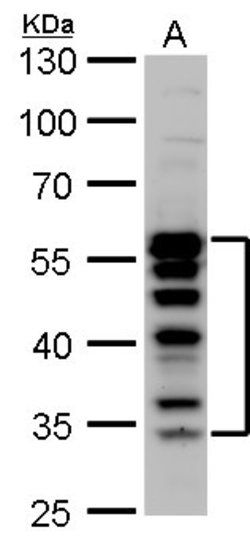Invitrogen TCF7 Polyclonal Antibody 100 &mu;L; Unconjugated:Antibodies,