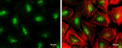 Invitrogen TCF7L2 Polyclonal Antibody 100 &mu;L; Unconjugated:Antibodies,