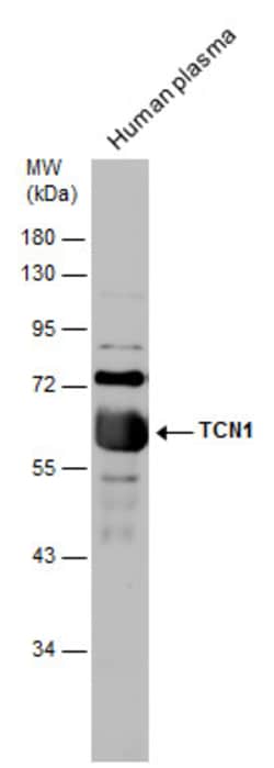 Invitrogen TCN1 Polyclonal Antibody 100 &mu;L; Unconjugated:Antibodies,