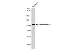 Invitrogen TOP1 Polyclonal Antibody 100 &mu;L; Unconjugated:Antibodies,