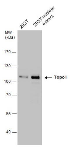 Invitrogen TOP1 Polyclonal Antibody 100 &mu;L; Unconjugated:Antibodies,