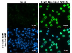 Invitrogen Phospho-p53 (Ser15) Polyclonal Antibody 100 &mu;L; Unconjugated:Antibodies,