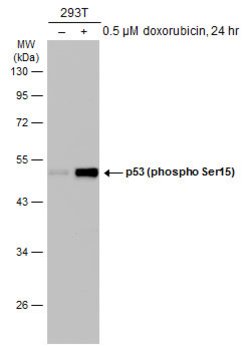 Invitrogen Phospho-p53 (Ser15) Polyclonal Antibody 100 &mu;L; Unconjugated:Antibodies,