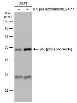 Invitrogen Phospho-p53 (Ser46) Polyclonal Antibody 100 &mu;L | Buy Online | Invitrogen&trade; | Fisher Scientific