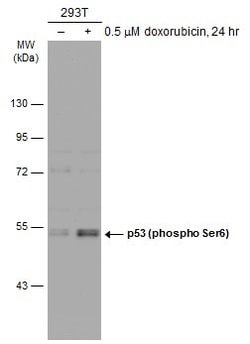 Invitrogen Phospho-p53 (Ser6) Polyclonal Antibody 100 &mu;L; Unconjugated:Antibodies,