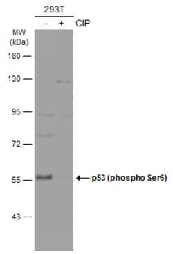 Invitrogen Phospho-p53 (Ser6) Polyclonal Antibody 100 &mu;L; Unconjugated:Antibodies,