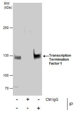 Invitrogen TTF1 Polyclonal Antibody 100 &mu;L; Unconjugated:Antikörper