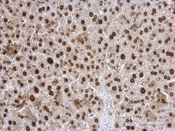 Invitrogen Twist1/Twist2 Polyclonal Antibody 100 &mu;L; Unconjugated:Antibodies,