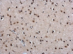 Invitrogen Twist1/Twist2 Polyclonal Antibody 100 &mu;L; Unconjugated:Antibodies,