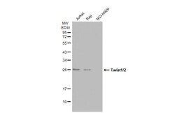 Invitrogen Twist1/Twist2 Polyclonal Antibody 100 &mu;L; Unconjugated:Antibodies,