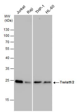 Invitrogen Twist1/Twist2 Polyclonal Antibody 100 &mu;L; Unconjugated:Antibodies,