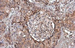 Invitrogen Uteroglobin Polyclonal Antibody 100 &mu;L; Unconjugated:Antibodies,