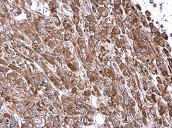 Invitrogen VASP Polyclonal Antibody 100 &mu;L; Unconjugated:Antibodies,