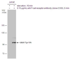 Invitrogen Phospho-VAV1 (Tyr174) Polyclonal Antibody 100 &mu;L; Unconjugated:Antibodies,
