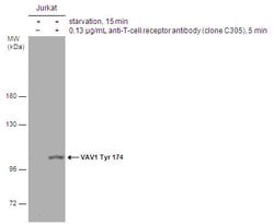 Invitrogen Phospho-VAV1 (Tyr174) Polyclonal Antibody 100 &mu;L; Unconjugated:Antibodies,