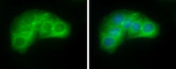 Invitrogen Villin Polyclonal Antibody 100 &mu;L; Unconjugated:Antibodies,