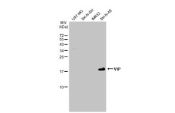 Invitrogen VIP Polyclonal Antibody 100 &mu;L; Unconjugated:Antibodies,