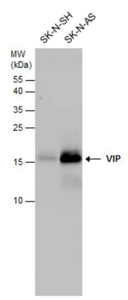 Invitrogen VIP Polyclonal Antibody 100 &mu;L; Unconjugated:Antibodies,