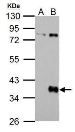 Invitrogen WNT9B Polyclonal Antibody 100 &mu;L; Unconjugated:Antibodies,