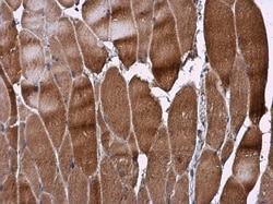 Invitrogen RAB7A Polyclonal Antibody 100 &mu;L; Unconjugated:Antibodies,