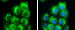 Invitrogen RAB7A Polyclonal Antibody 100 &mu;L; Unconjugated:Antibodies,