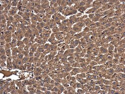 Invitrogen RAB7A Polyclonal Antibody 100 &mu;L; Unconjugated:Antibodies,