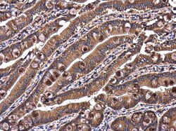 Invitrogen RAB7A Polyclonal Antibody 100 &mu;L; Unconjugated:Antibodies,
