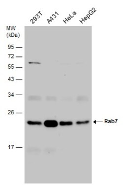 Invitrogen RAB7A Polyclonal Antibody 100 &mu;L; Unconjugated:Antibodies,