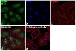 Invitrogen RAB7A Polyclonal Antibody 100 &mu;L; Unconjugated:Antibodies,