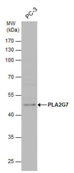 Invitrogen PLA2G7 Polyclonal Antibody 100 μL; Unconjugated:Antibodies,