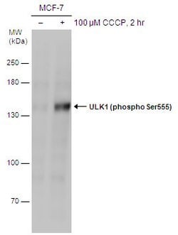Invitrogen Phospho-ULK1 (Ser555) Polyclonal Antibody 100 &mu;L; Unconjugated:Antibodies,