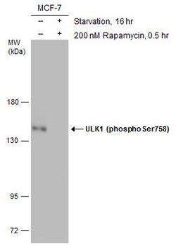 Invitrogen Phospho-ULK1 (Ser758) Polyclonal Antibody 100 &mu;L; Unconjugated:Antibodies,