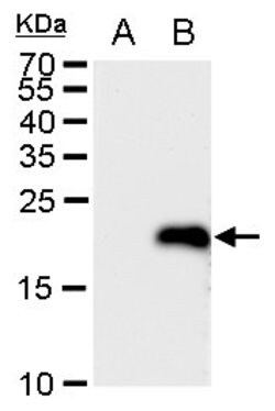 Invitrogen LMO4 Polyclonal Antibody 100 &mu;L | Buy Online | Invitrogen&trade; | Fisher Scientific
