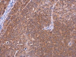 Invitrogen TCAP Polyclonal Antibody 100 &mu;L; Unconjugated:Antibodies,