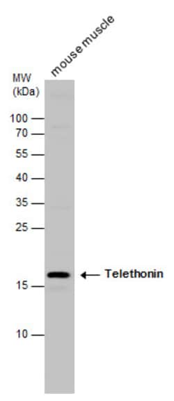 Invitrogen TCAP Polyclonal Antibody 100 &mu;L; Unconjugated:Antibodies,